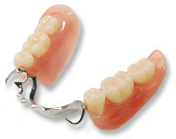 Prothèse dentaire - Dentalam